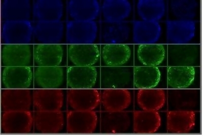 Un nuovo materiale per le staminali
