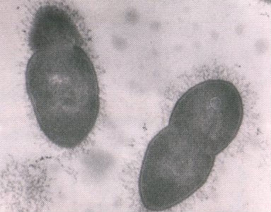 La meningite si scopre in un’ora