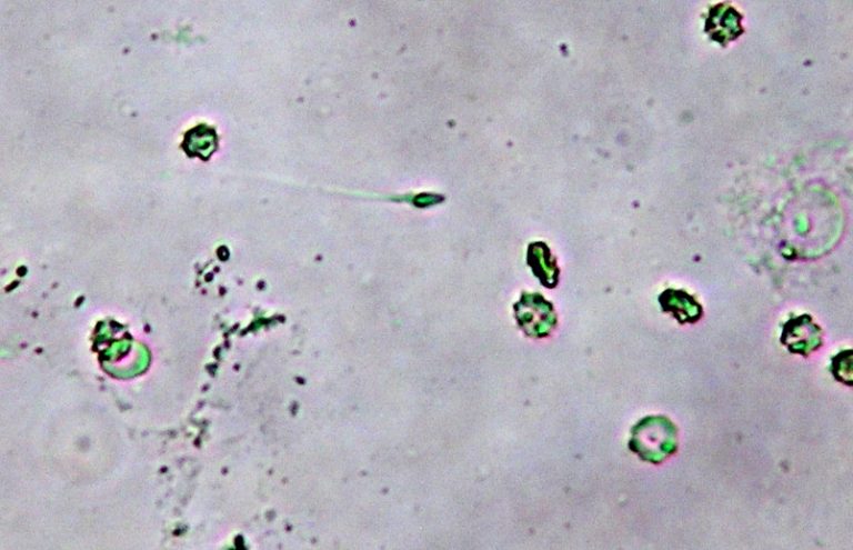 Un gene per la sterilità maschile inspiegata