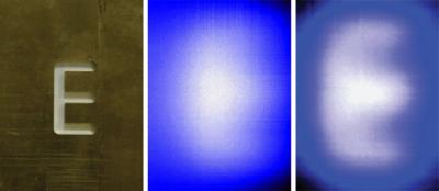 Ecografia ad alta risoluzione