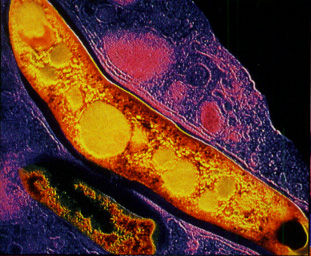 Contro la tbc ecco l’antibiotico in polvere