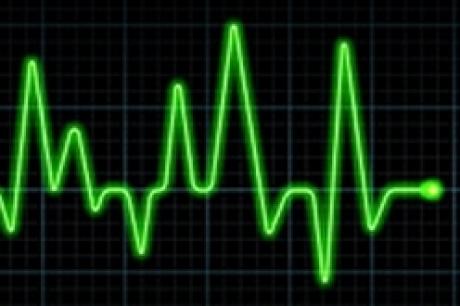 Ora l’infarto si studia nei pazienti anomali