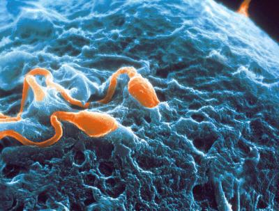 Infertilità: arrivano gli spermatozoi creati in laboratorio