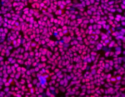 Staminali: un cocktail per bloccare la differenziazione