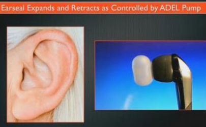 Gli auricolari che salvano l’udito