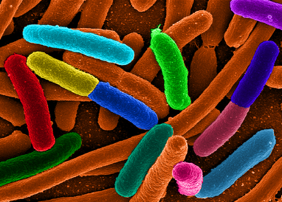 Batterio killer? Ne sentiremo parlare per altri 3 anni