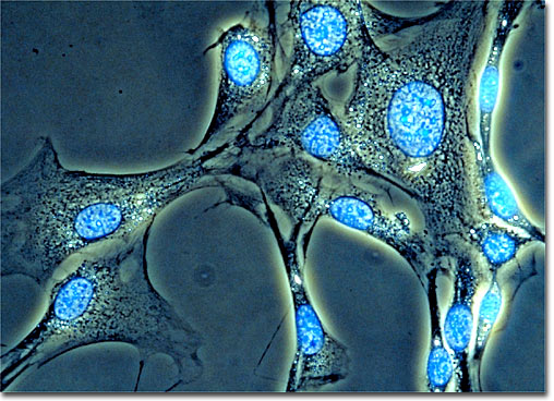 Contro il Parkinson, neuroni dai fibroblasti