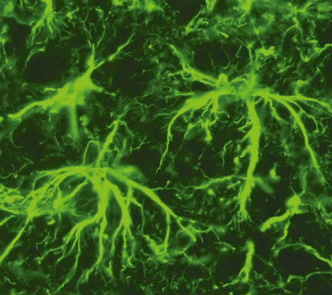 La depressione altera le cellule cerebrali