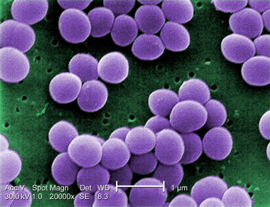 Resistenza agli antibiotici, una storia da 30.000 anni