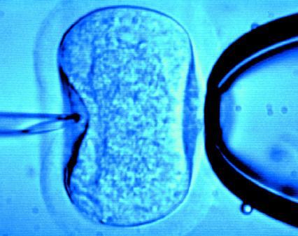 Europa: gli Stati possono vietare la fecondazione eterologa