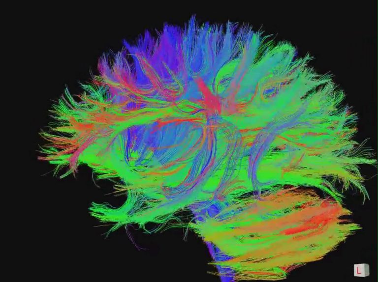effetti cocaina sul cervello
