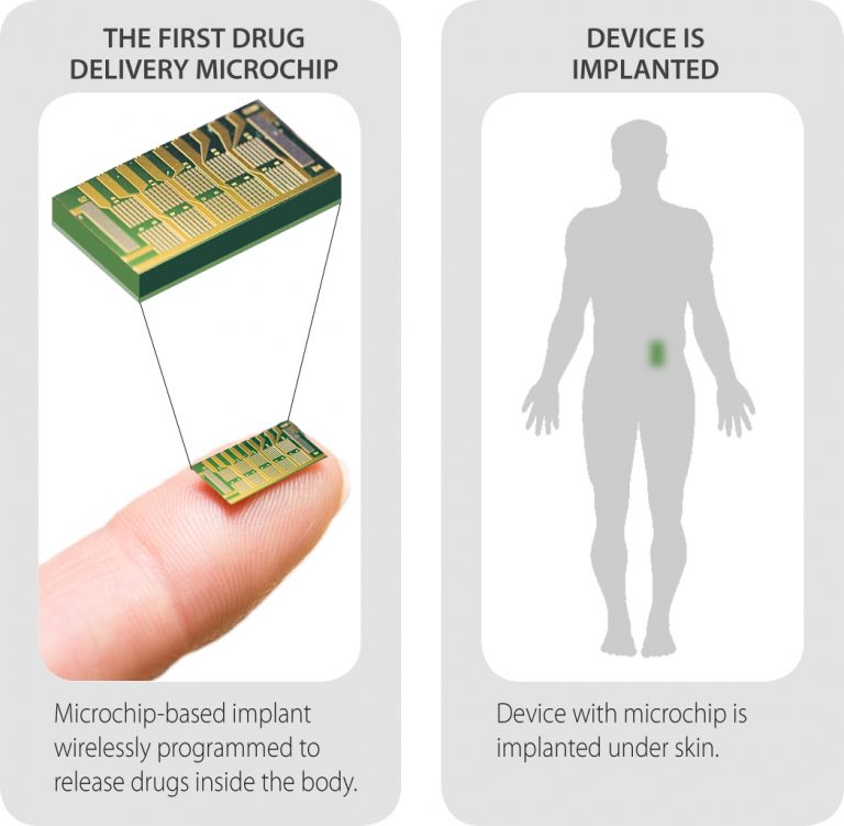 Il farmaco in un chip