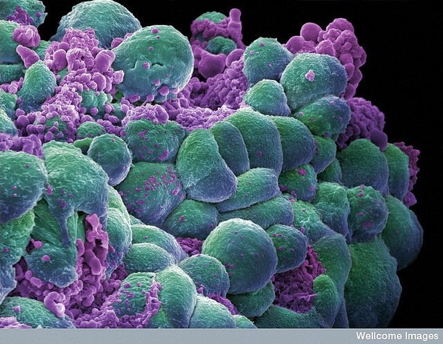 Arriva il database online sul cancro