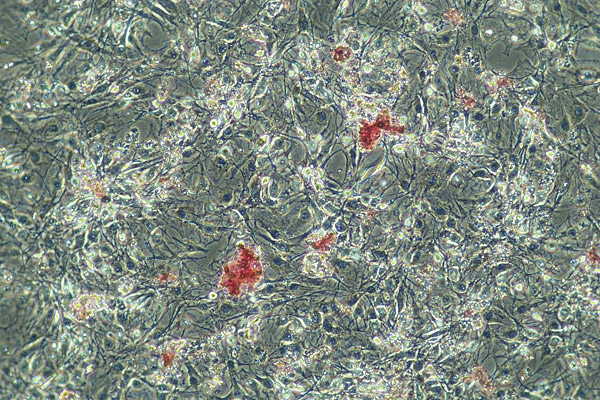 Endoglina, la proteina che blocca il grasso