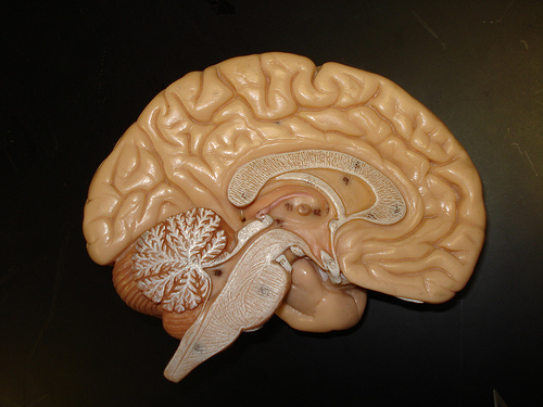 Un cervello artificiale da 2,5 milioni di neuroni