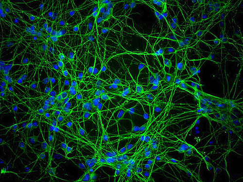 Staminali per recuperare la memoria