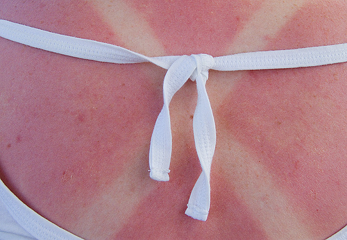 Abbronzarsi senza scottature, grazie a una molecola