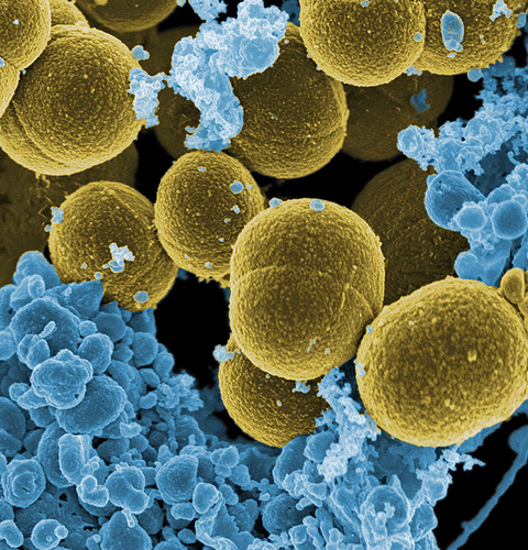 Contro il cancro il vaccino è batterico