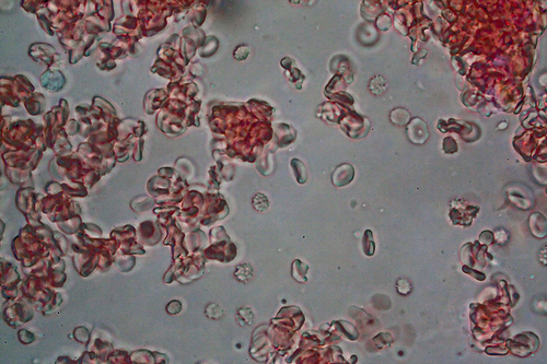 Cosa racconta il sangue di una supercentenaria