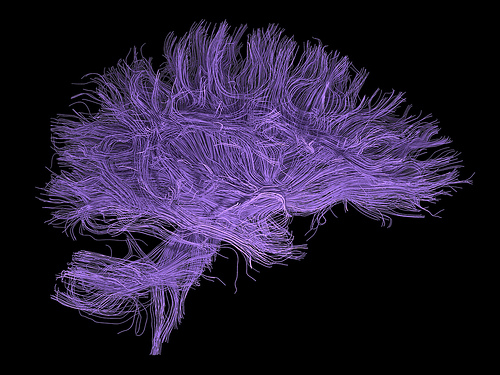 Il gene che potenzia le attività del cervello