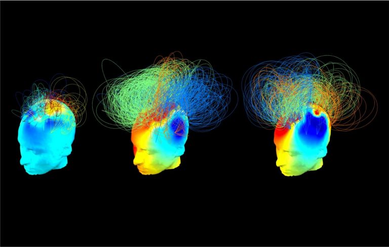 Riconoscere la coscienza anche nei pazienti in coma