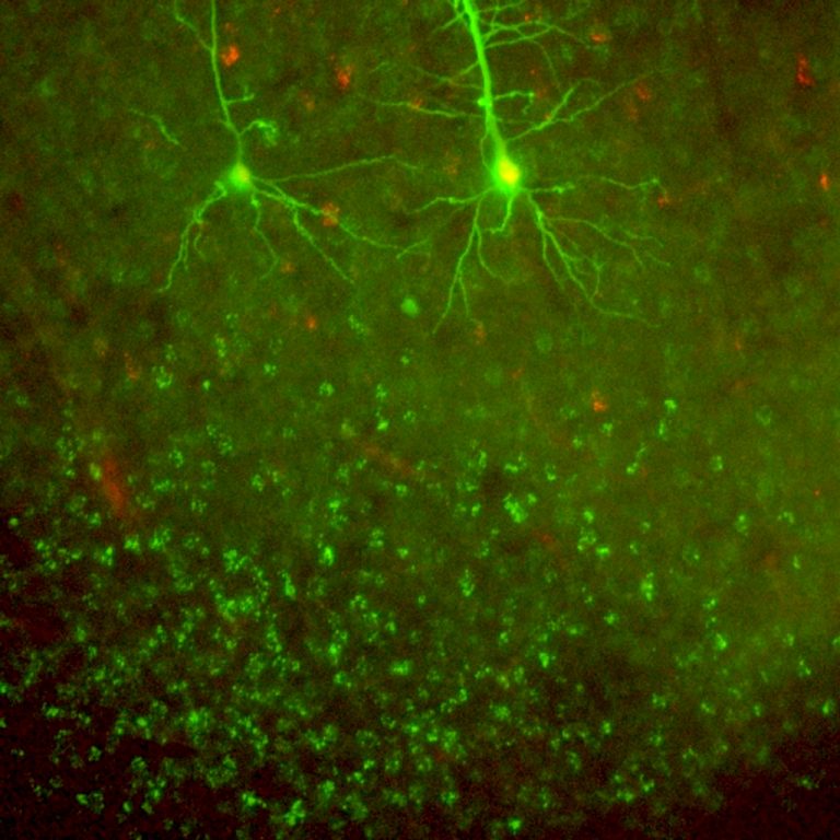 Cellule staminali contro il Parkinson