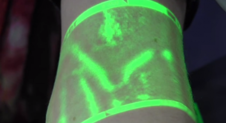 Iniezioni più semplici grazie alla luce infrarossa