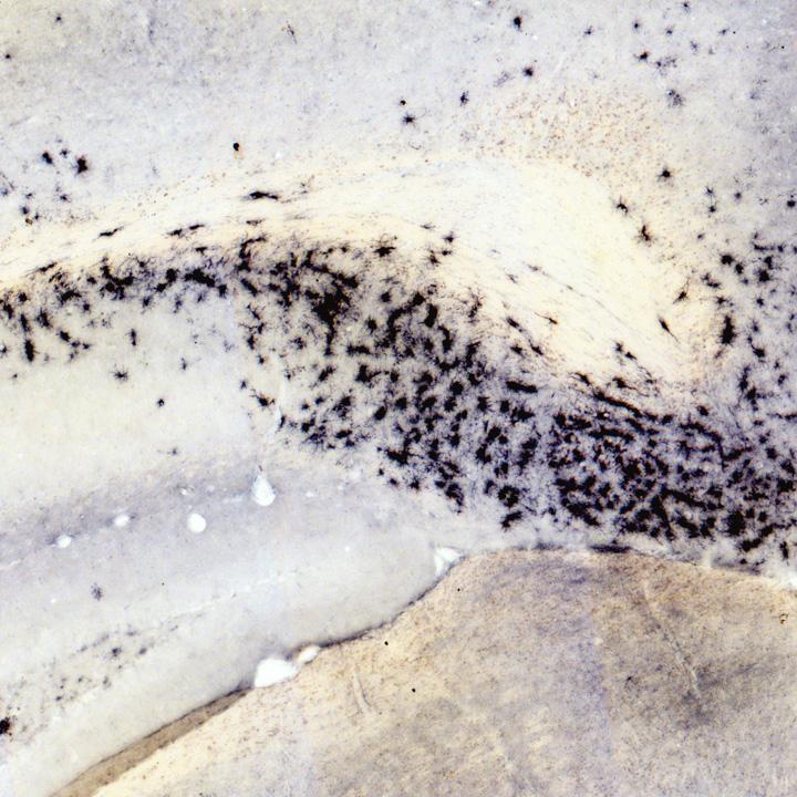 Poca arginina: la nuova ipotesi per spiegare l’Alzheimer