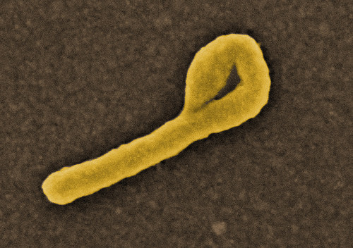 Ebola, buone notizie per un vaccino