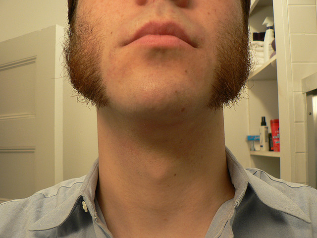 Contro i problemi alla tiroide: poco sale ma iodato