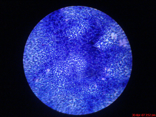 Ad ognuno la sua nuvola di batteri