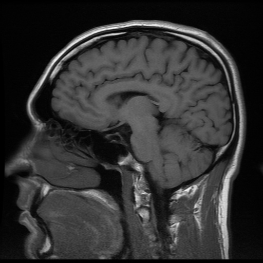 L’atteggiamento positivo è nel cervello