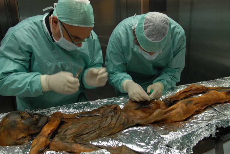 Helicobacter nello stomaco della mummia Ötzi