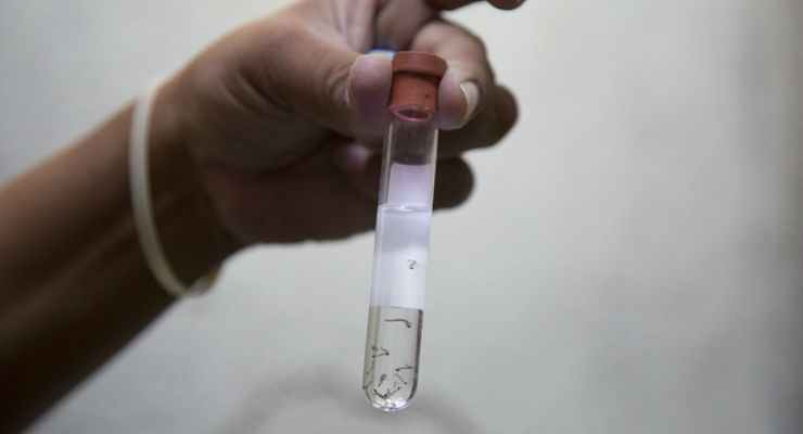 Zika, il virus nel cervello di un feto