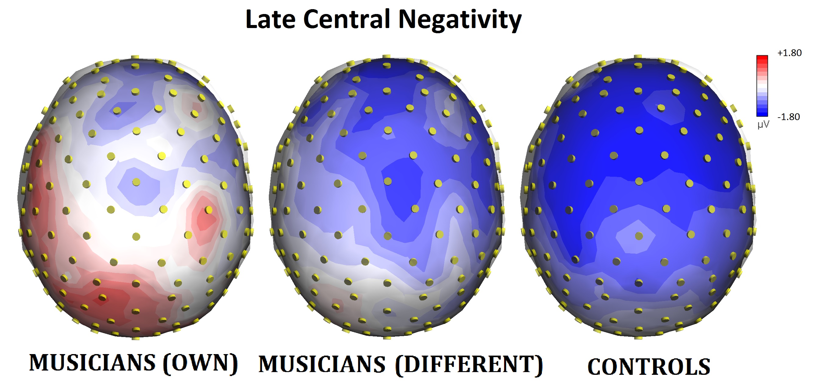 Figura 2 - Late Central Negativity