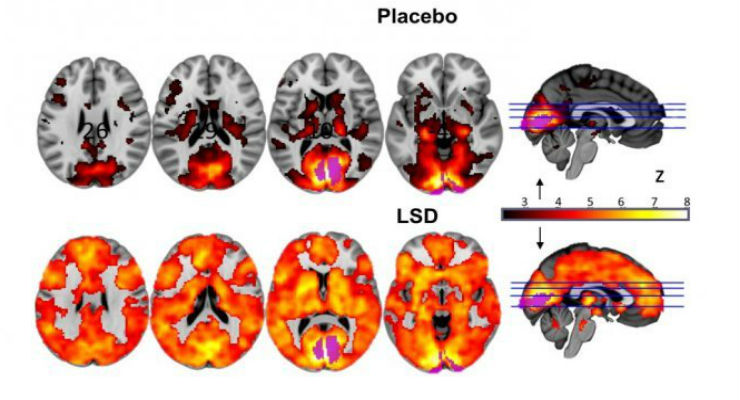 Lsd