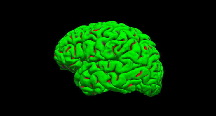 cervello 3