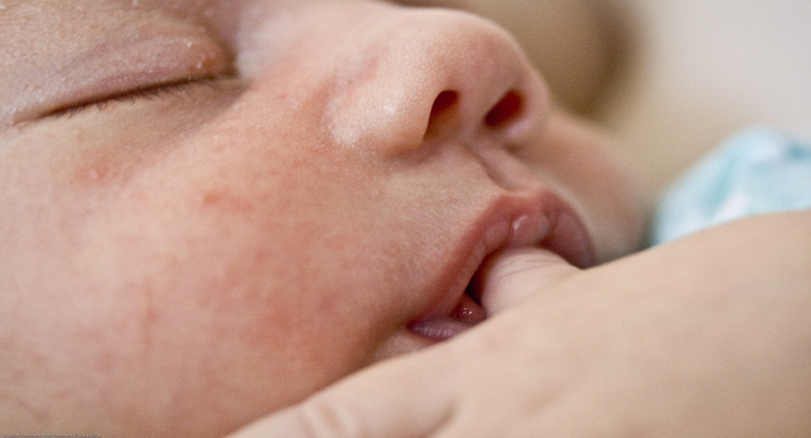 Succhiarsi il pollice? Un vizio che abbassa il rischio di allergie