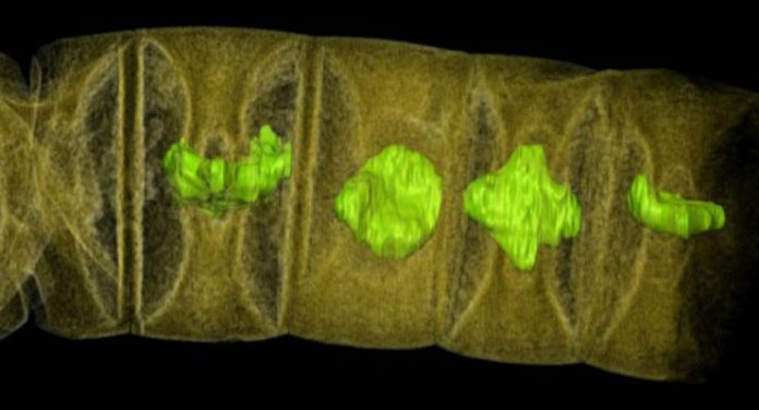 alga