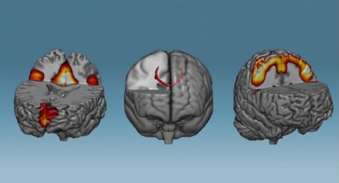 neurofeedback