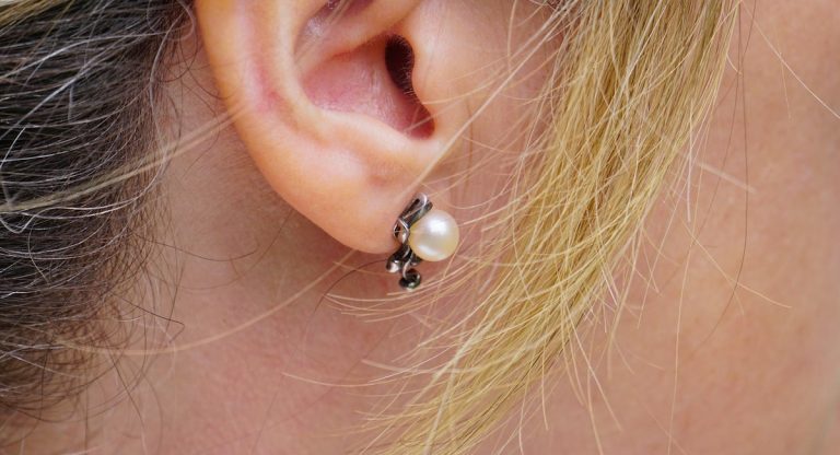 acufene stimolazione cerebrale profonda