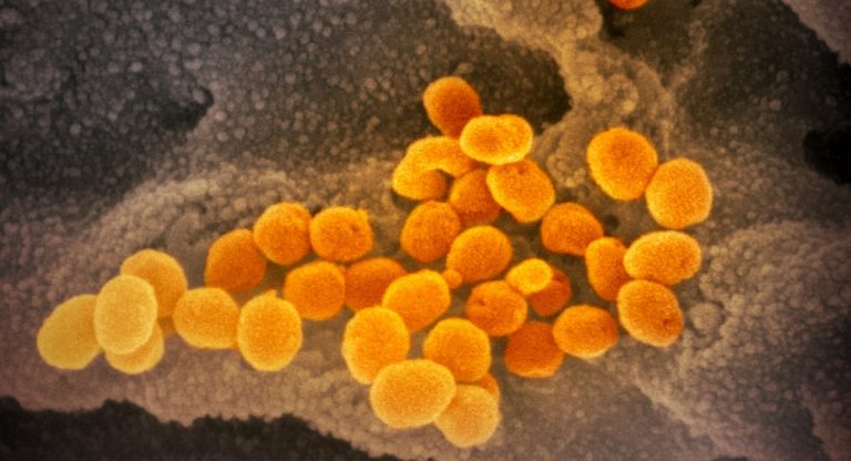 coronavirus