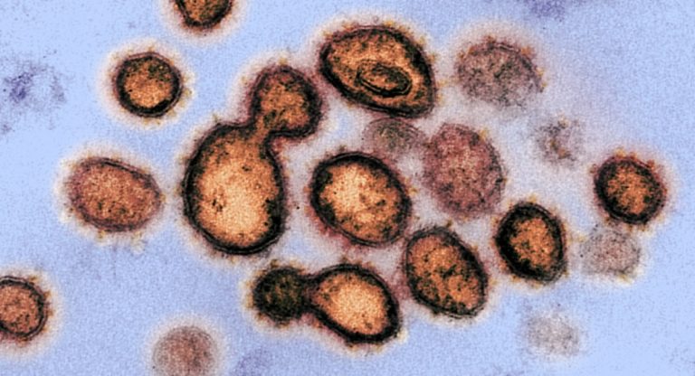 coronavirus