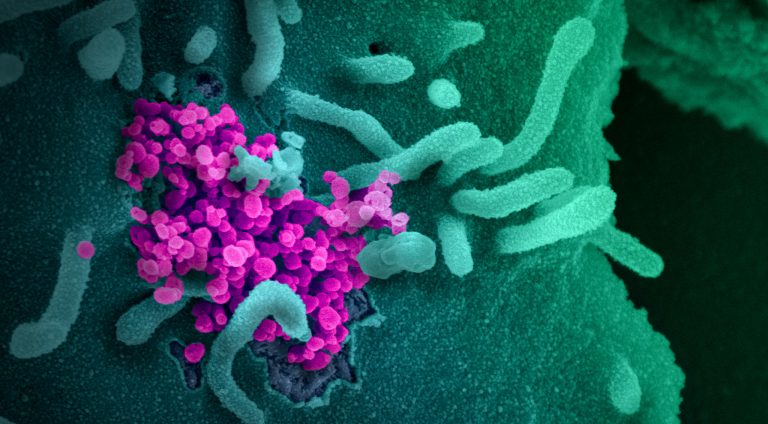 covid-19 coronavirus