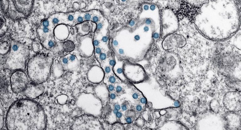 coronavirus