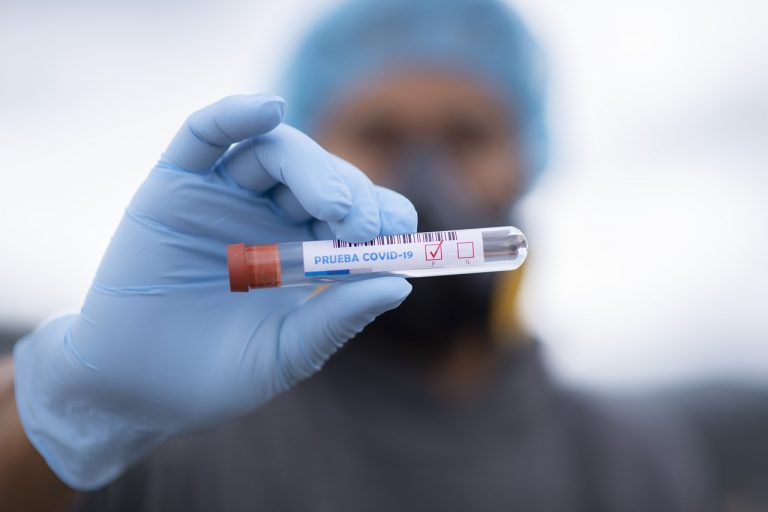 test sierologico tampone immunità anticorpi positivo negativo immunoglobuline igm igg