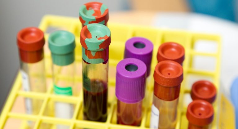 covid coronavirus sangue gruppo sanguigno test