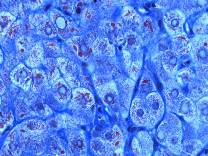 fegato trapianti rigenerare cellule linfonodi