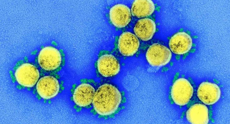 coronavirus