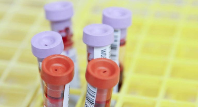 Cosa c’è da sapere sui tre casi di ictus associati al vaccino di AstraZeneca